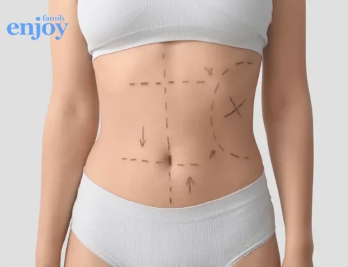 Mommy Makeover : une chirurgie esthétique post-grossesse de plus en plus populaire